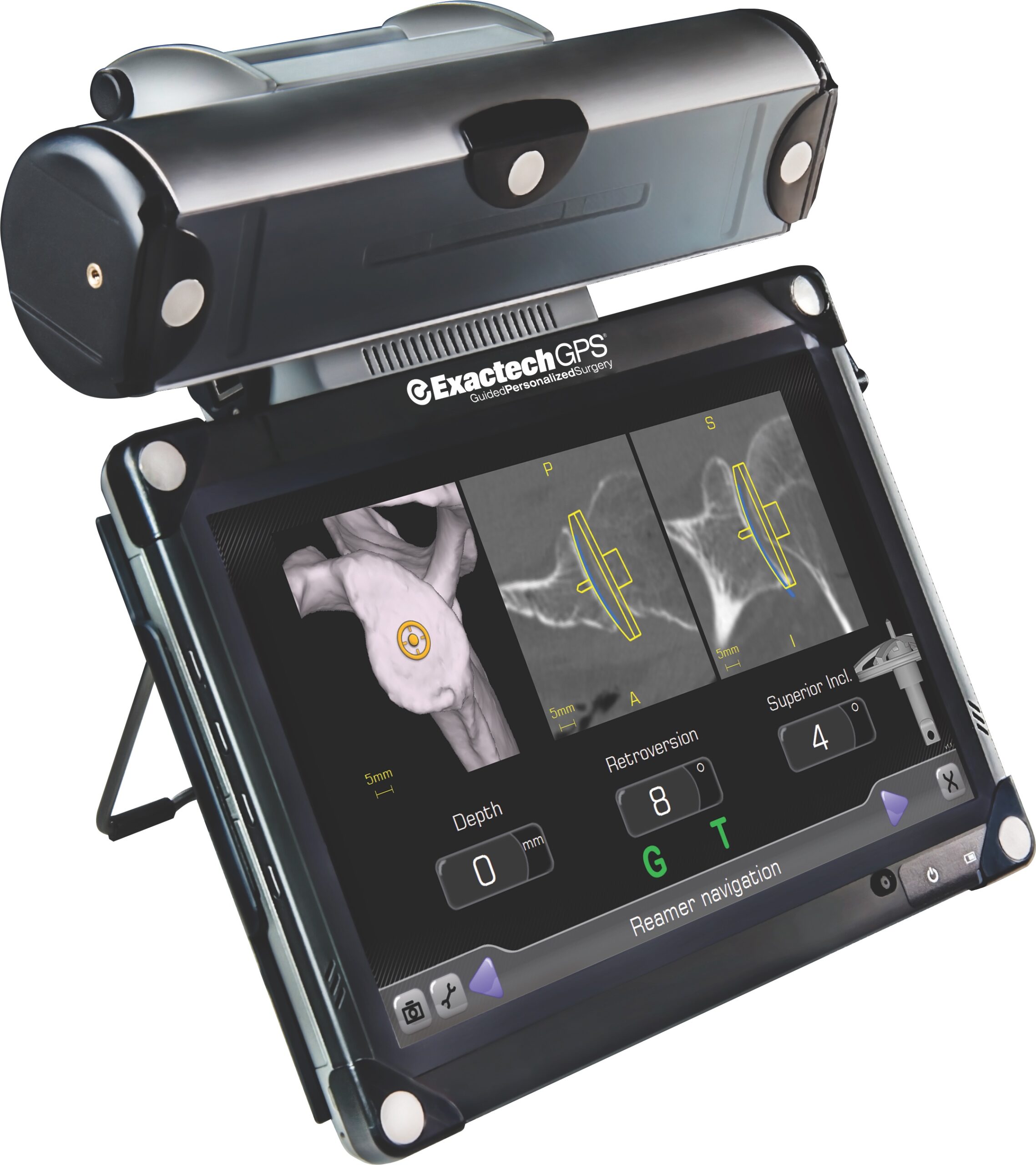 Exactech GPS for Shoulder Surgery