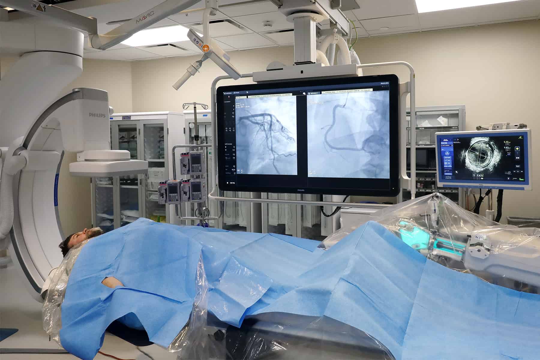 A patient getting a cardiac scan